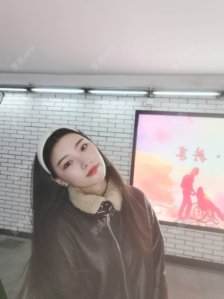 更美 - 更美用户82701801的隐形牙齿矫正经验 | 杭州