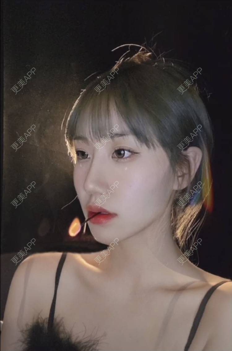 更美 - 白白白嫩嫩嫩的人中缩短经验 | 人中缩短 | 蚌埠