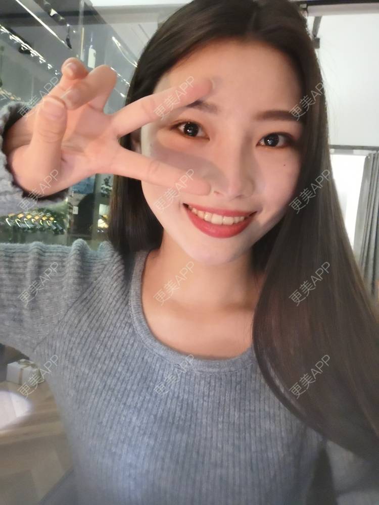 更美 - 更美用户82701801的隐形牙齿矫正经验 | 杭州