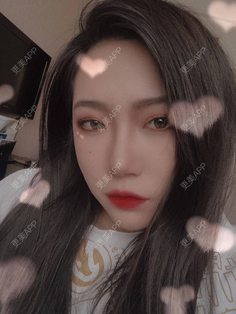 更美 - L李小豆儿的鼻部多项经验 | 杭州 | 视频日记 | 鼻部多项