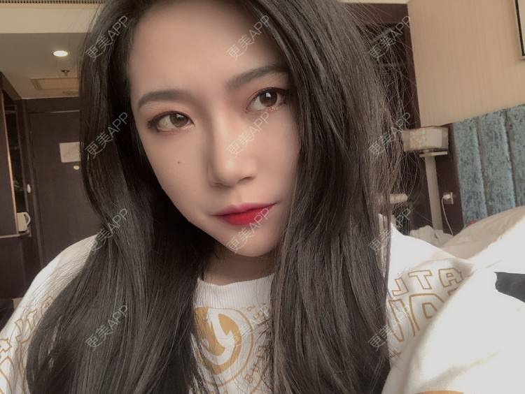 更美 - L李小豆儿的鼻部多项经验 | 杭州 | 视频日记 | 鼻部多项