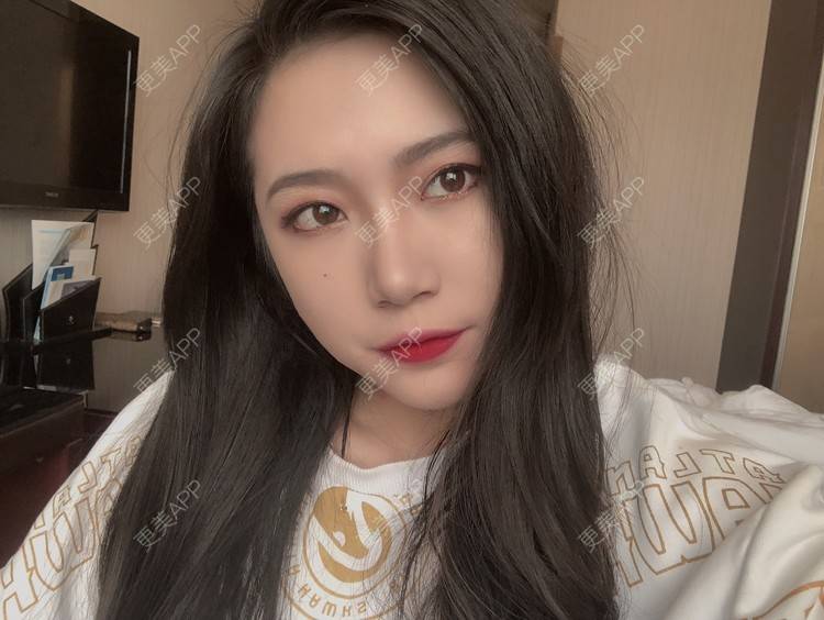 更美 - L李小豆儿的鼻部多项经验 | 杭州 | 视频日记 | 鼻部多项
