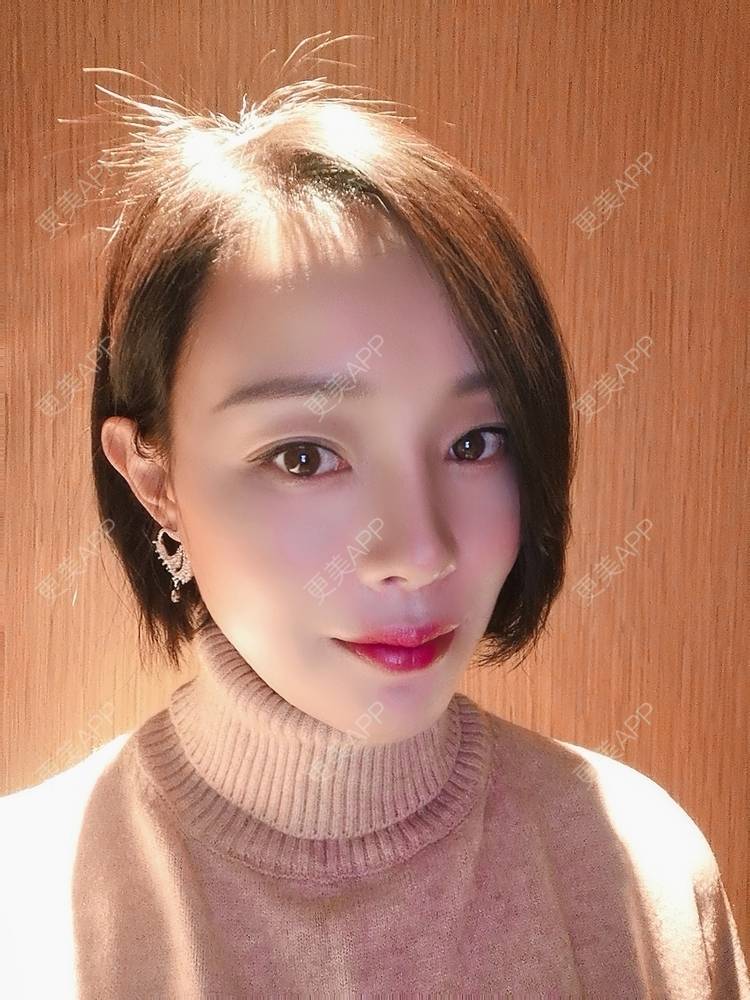 更美 - 🐷🐮仔仔仔的热玛吉经验 | 热玛吉 | 上海