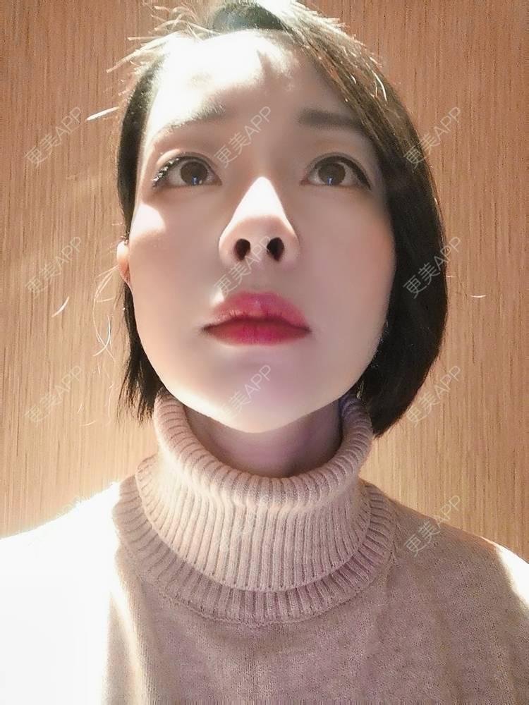 更美 - 🐷🐮仔仔仔的热玛吉经验 | 热玛吉 | 上海
