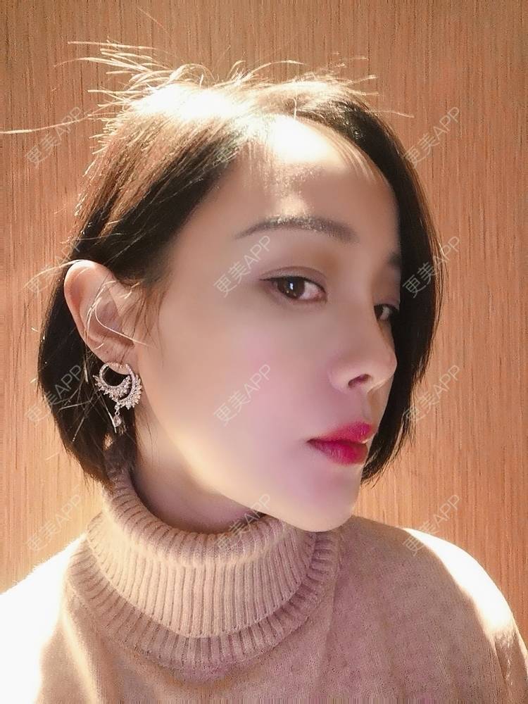 更美 - 🐷🐮仔仔仔的热玛吉经验 | 热玛吉 | 上海