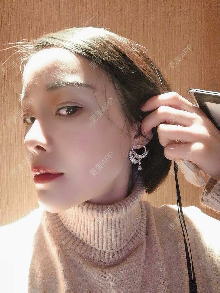 更美 - 🐷🐮仔仔仔的热玛吉经验 | 热玛吉 | 上海