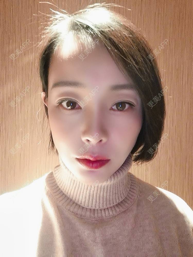 更美 - 🐷🐮仔仔仔的热玛吉经验 | 热玛吉 | 上海