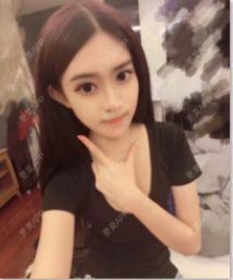 更美 - 更美用户kd3qpAyZgz的手术除腋臭经验 | 手术除腋臭