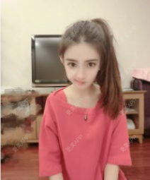 更美 - 更美用户kd3qpAyZgz的手术除腋臭经验 | 手术除腋臭