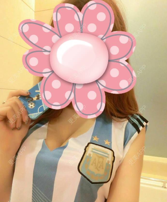 更美 - 忧伤小猫咪仲的阴蒂整形经验 | 北京 | 阴蒂整形