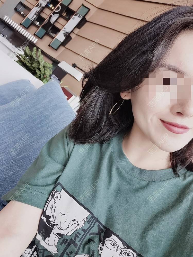更美 - 小小板板凳凳儿的人中缩短经验 | 人中缩短