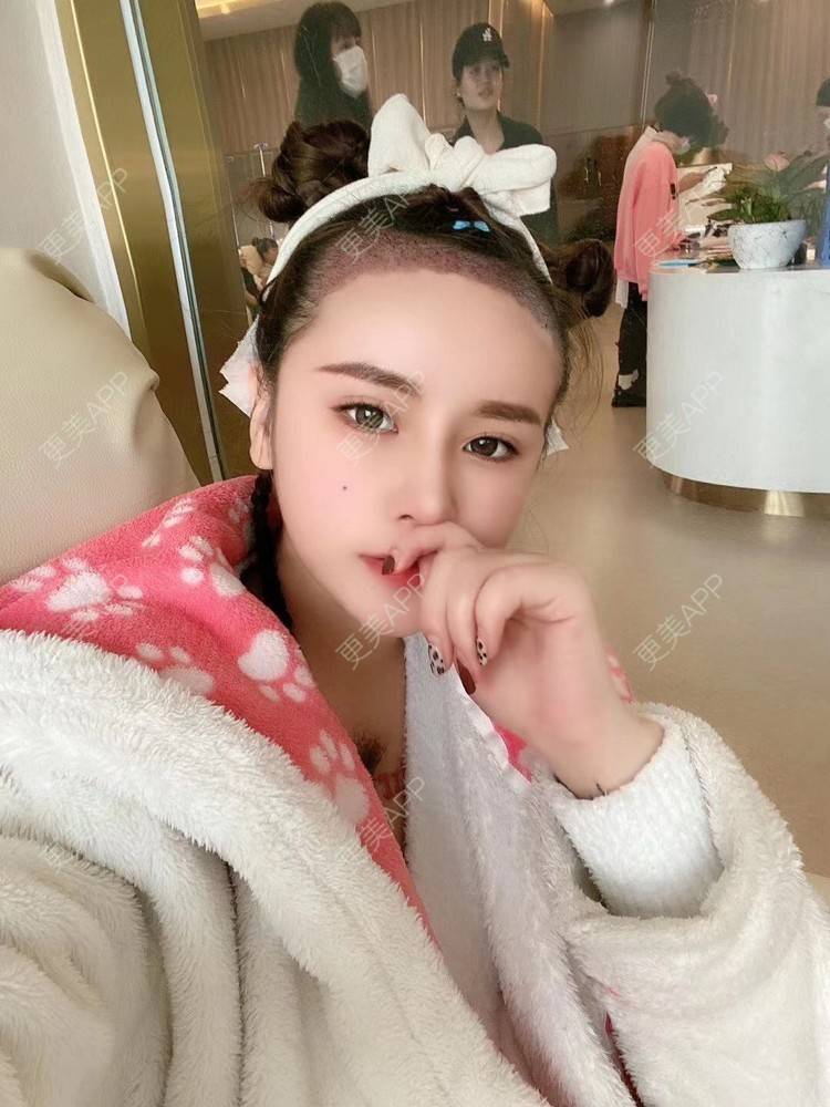 更美 - 祢的美丽/我的职责的植发际线经验 | 植发际线 | 上海