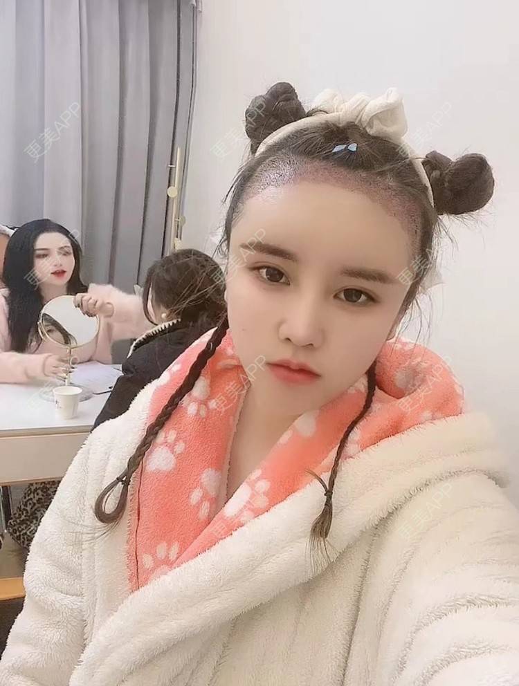 更美 - 祢的美丽/我的职责的植发际线经验 | 植发际线 | 上海