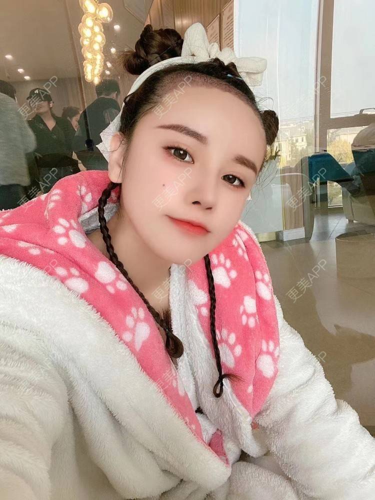 更美 - 祢的美丽/我的职责的植发际线经验 | 植发际线 | 上海