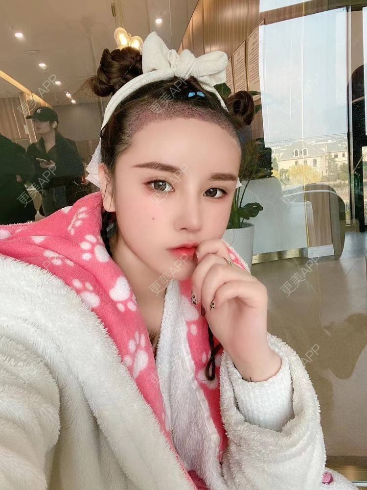 更美 - 祢的美丽/我的职责的植发际线经验 | 植发际线 | 上海