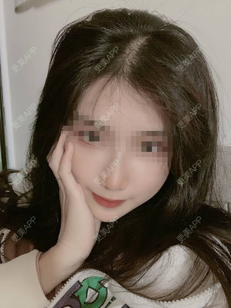 更美 - 更美用户4mlEuaE3YZ的美白套餐经验 | 美白套餐