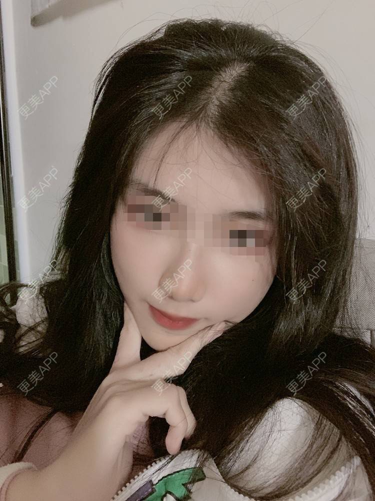 更美 - 更美用户4mlEuaE3YZ的美白套餐经验 | 美白套餐