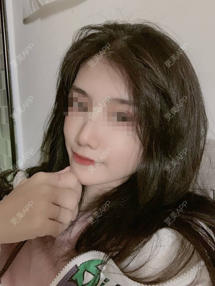 更美 - 更美用户4mlEuaE3YZ的美白套餐经验 | 美白套餐