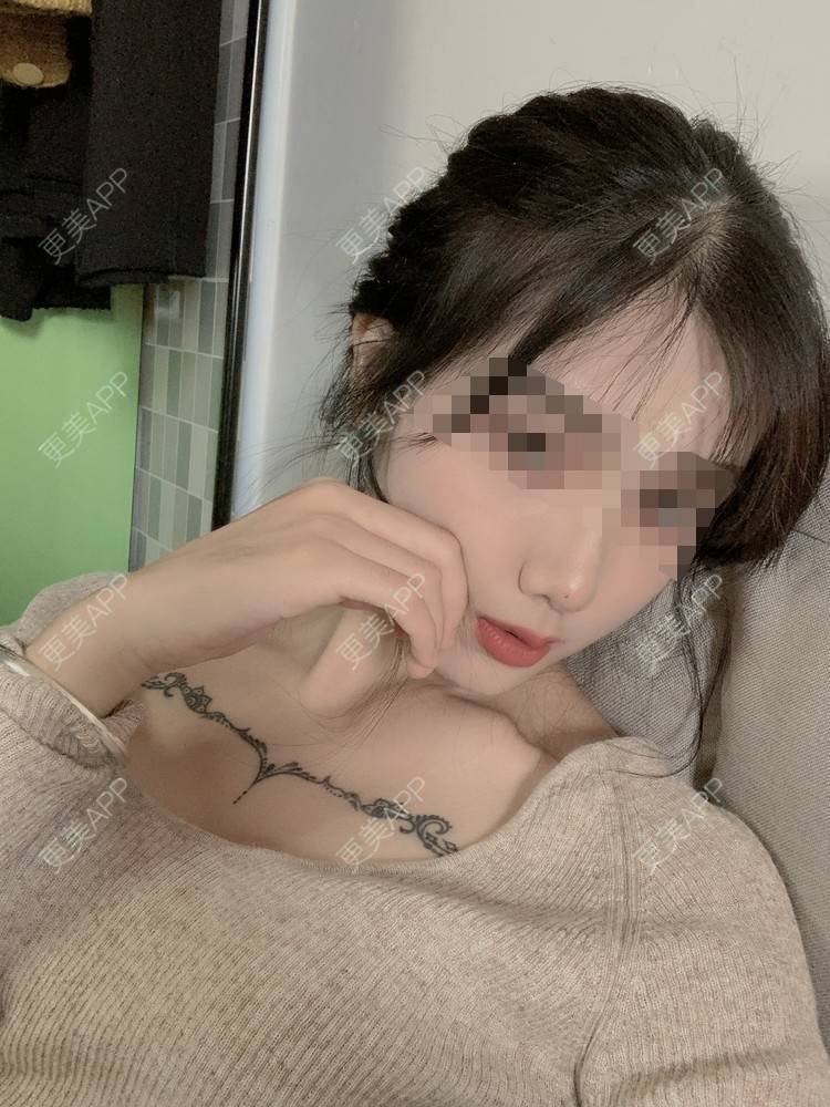 更美 - 更美用户4mlEuaE3YZ的美白套餐经验 | 美白套餐