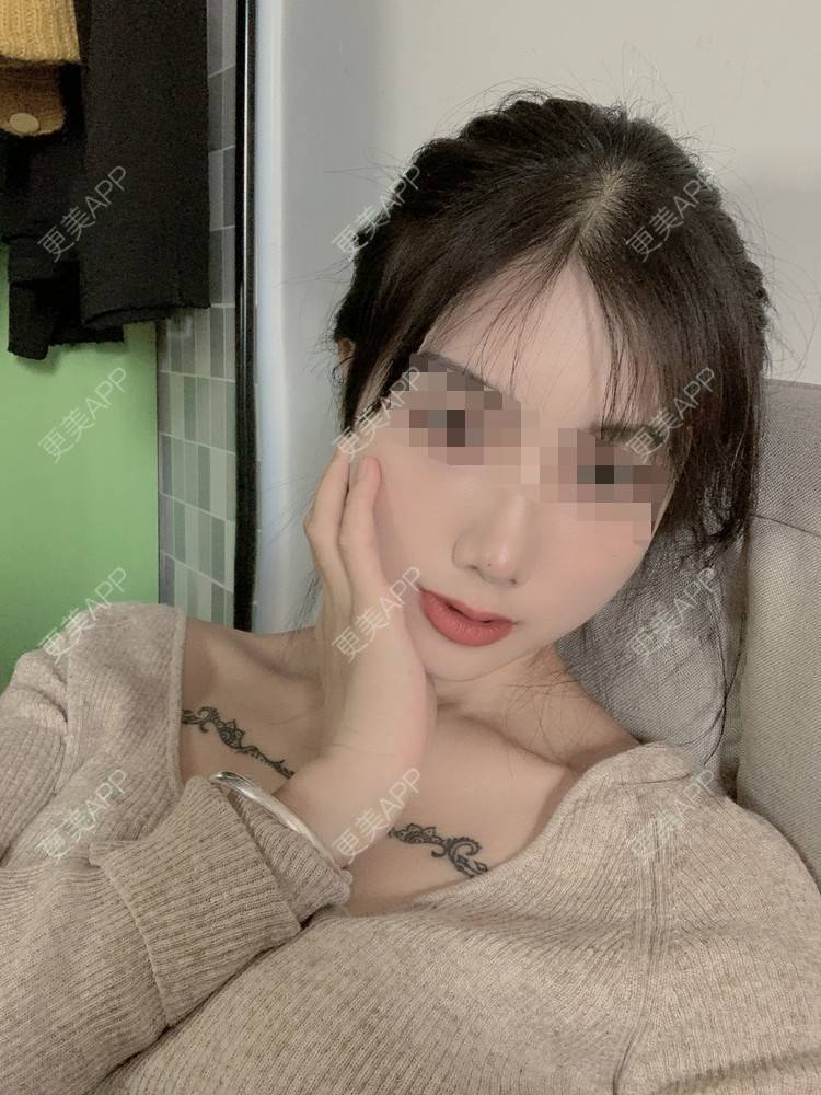 更美 - 更美用户4mlEuaE3YZ的美白套餐经验 | 美白套餐