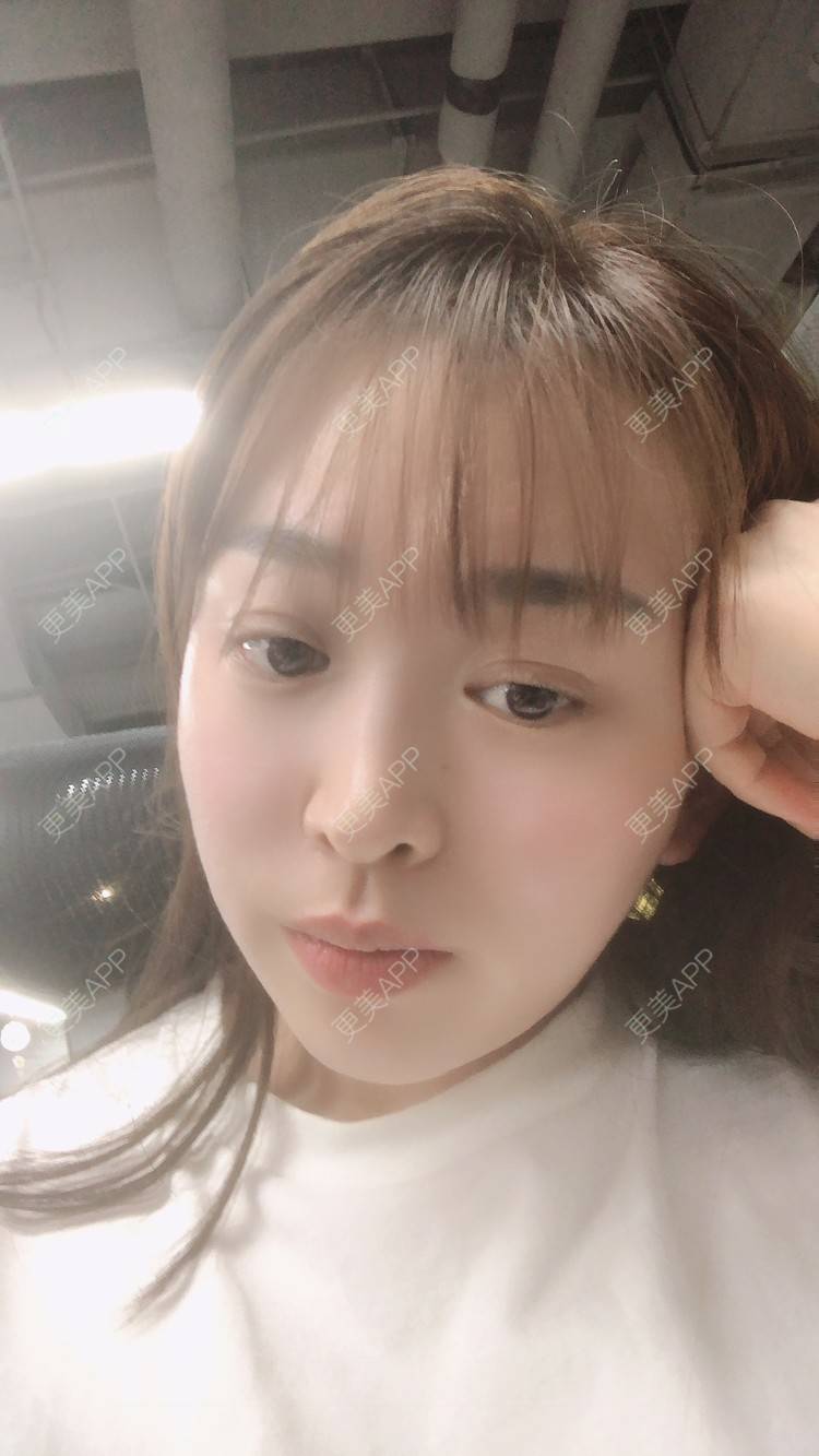 更美 - 更美用户nOSa2OXrxm的冷光美白经验 | 北京 | 冷光美白