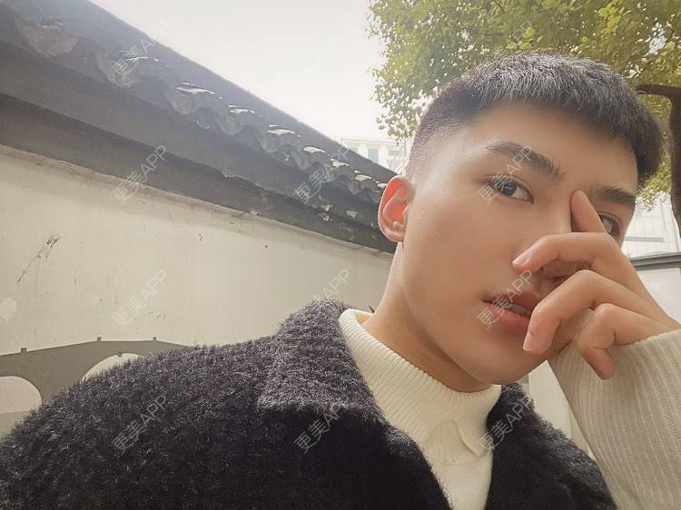 更美 - 晓明a的玻尿酸鼻部经验 | 玻尿酸下巴 | 玻尿酸鼻部 | 杭州