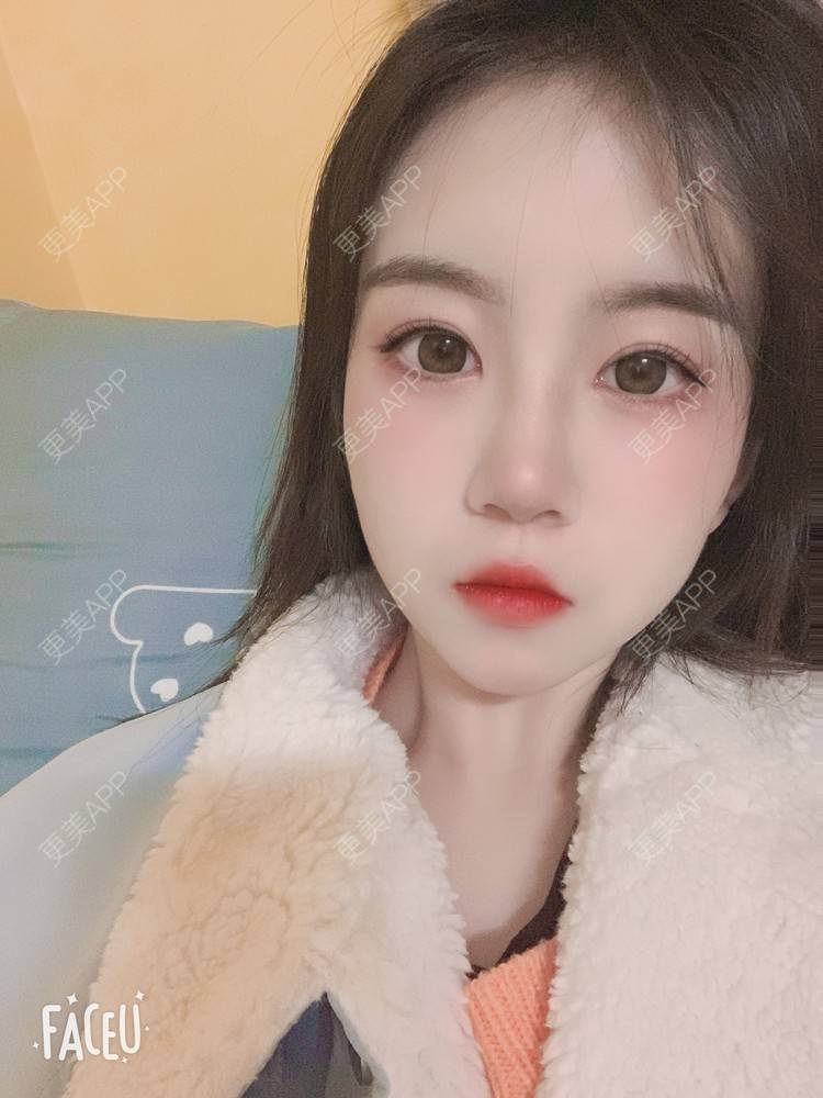 更美 - 甜宠女主的除皱瘦脸经验 | 除皱瘦脸 | 深圳