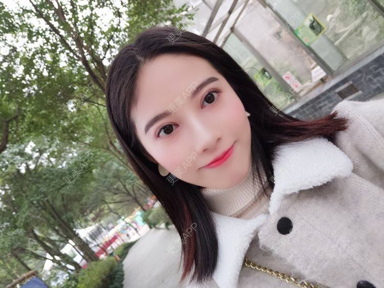 更美 - 美哒哒的婷怪咖的全切双眼皮经验 | 视频日记 | 全切双眼皮 | 重庆