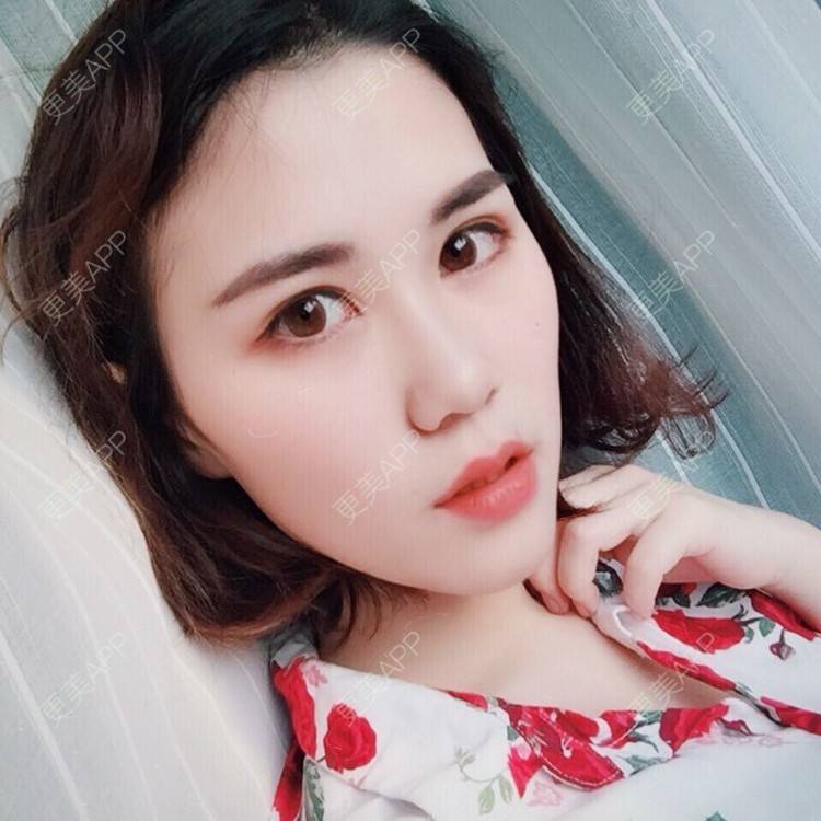更美 - 我会有猫的i的双眼皮经验 | 视频日记 | 双眼皮 | 重庆