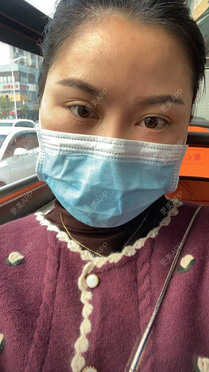 更美 - 更美用户XZl9FM68Hc的玻尿酸颈纹经验 | 玻尿酸颈纹 | 东莞