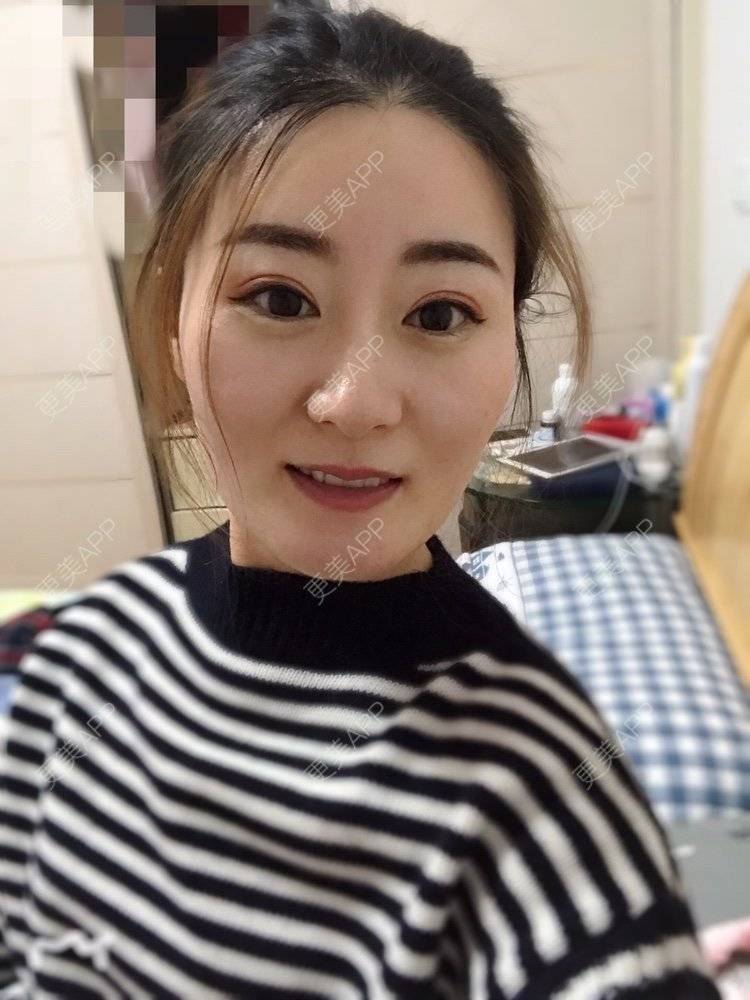 更美 - 更美用户zX5bT64g9Z的半永久纹眉经验 | 半永久纹眉 | 常州