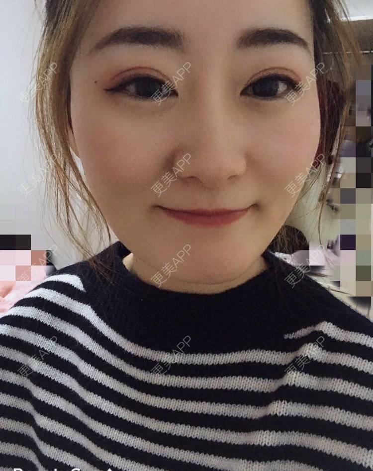 更美 - 更美用户zX5bT64g9Z的半永久纹眉经验 | 半永久纹眉 | 常州