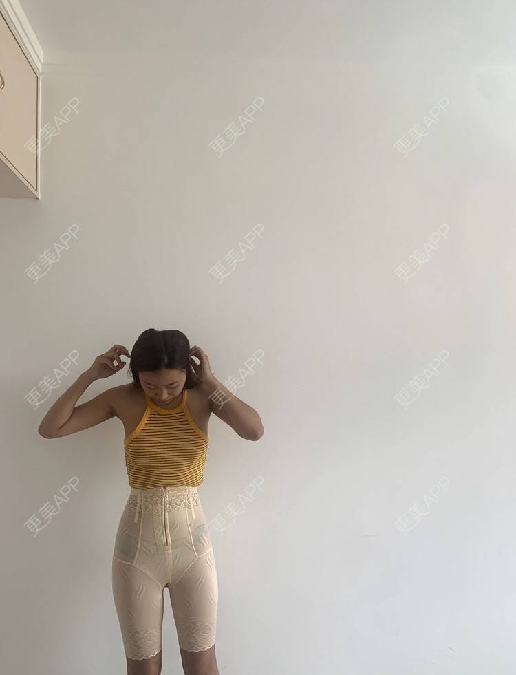 更美 - 更美用户4vKb9eTt9x的射频溶脂瘦腰部经验 | 射频溶脂瘦腰部 | 射频溶脂瘦腹部