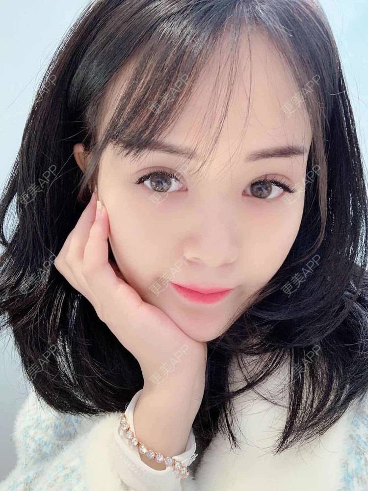 更美 - 草莓味之夏的双眼皮经验 | 眼部多项 | 广州 | 视频日记 | 双眼皮