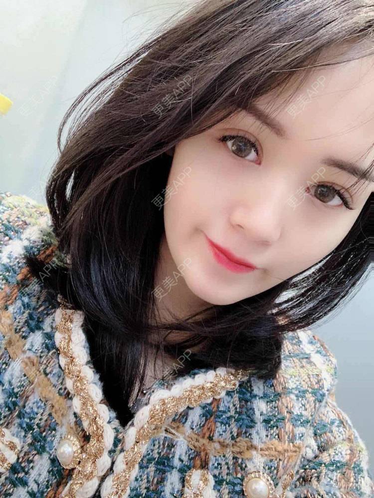 更美 - 草莓味之夏的双眼皮经验 | 眼部多项 | 广州 | 视频日记 | 双眼皮