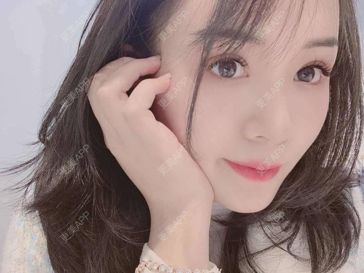 更美 - 草莓味之夏的双眼皮经验 | 眼部多项 | 广州 | 视频日记 | 双眼皮