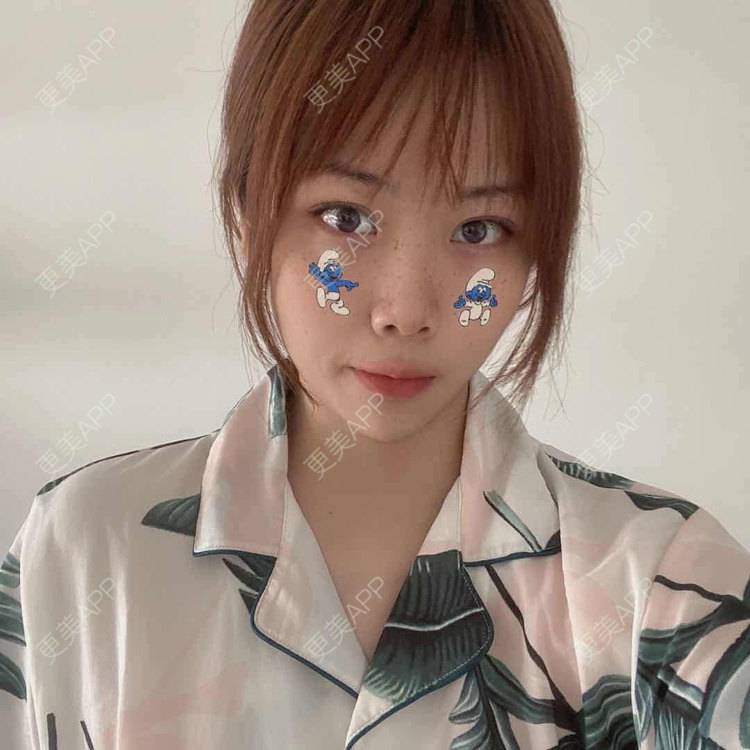 更美 - 悦悦悦耳的双眼皮经验 | 广州 | 双眼皮