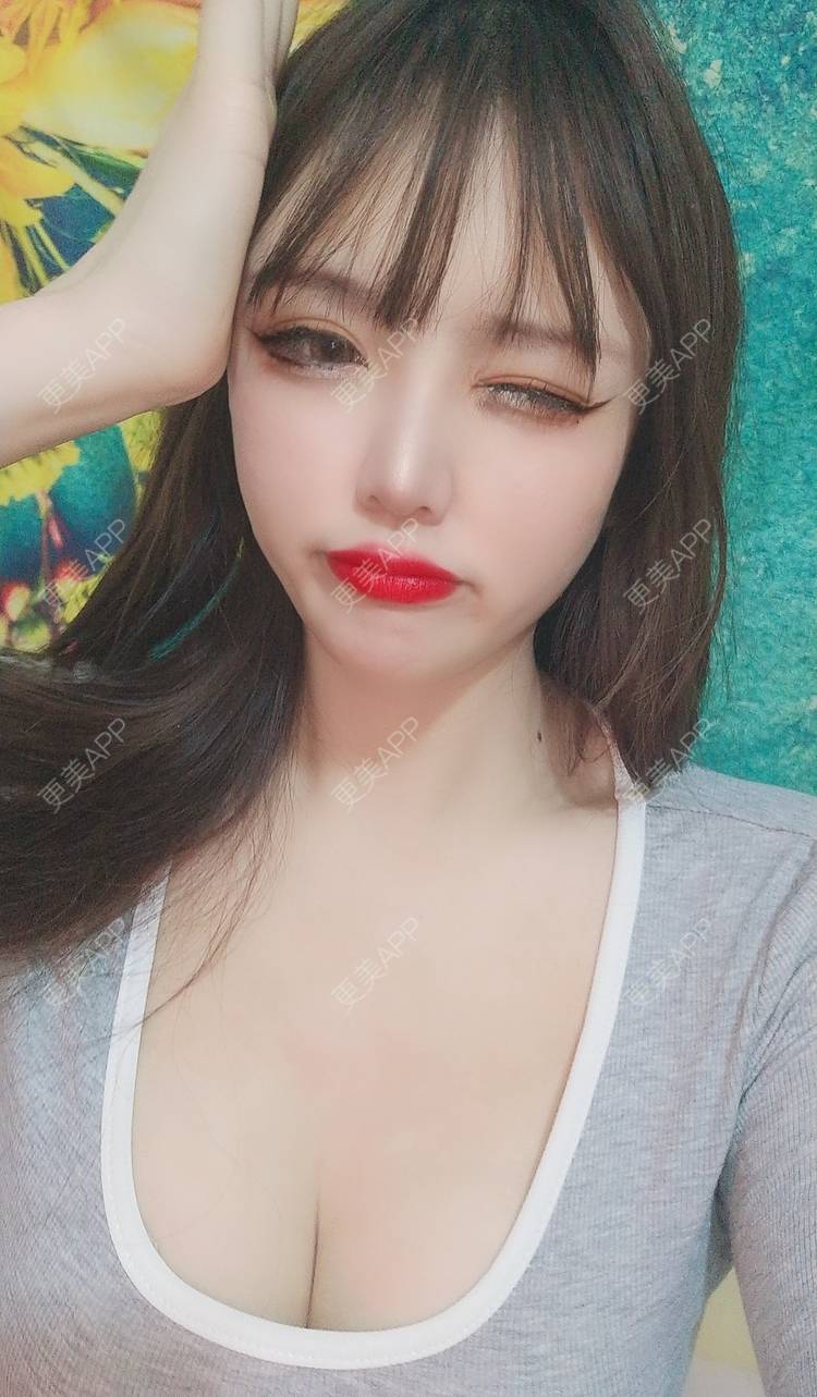 更美 - 晴天baby的假体隆胸经验 | 假体隆胸 | 郑州