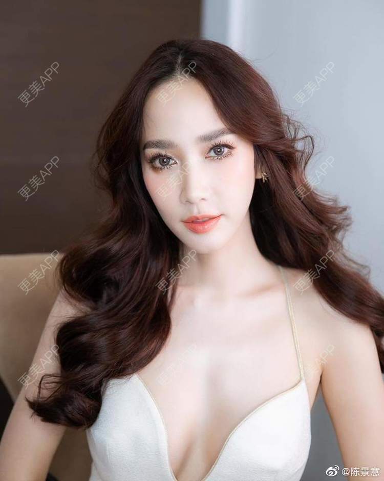 更美 - 更美用户gaIMBNcpBs的玻尿酸苹果肌经验 | 玻尿酸苹果肌 | 玻尿酸下巴 | 成都