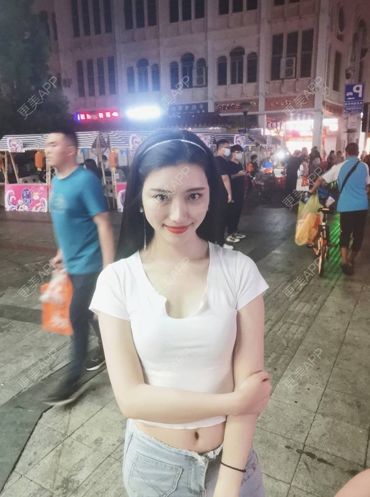 更美 - 更美用户82701801的隐形牙齿矫正经验 | 杭州