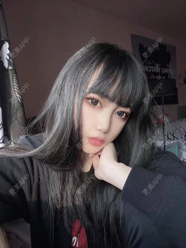 更美 - 柠檬很芒的下颌角切除经验 | 广州 | 下颌角切除