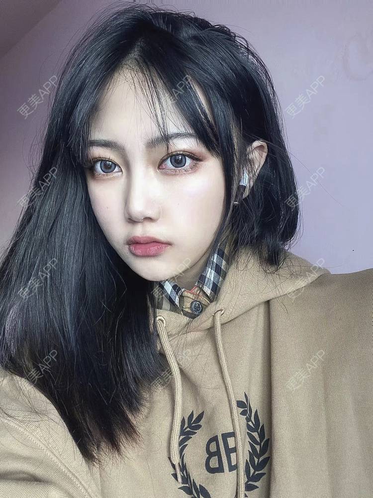 更美 - 柠檬很芒的下颌角切除经验 | 广州 | 下颌角切除