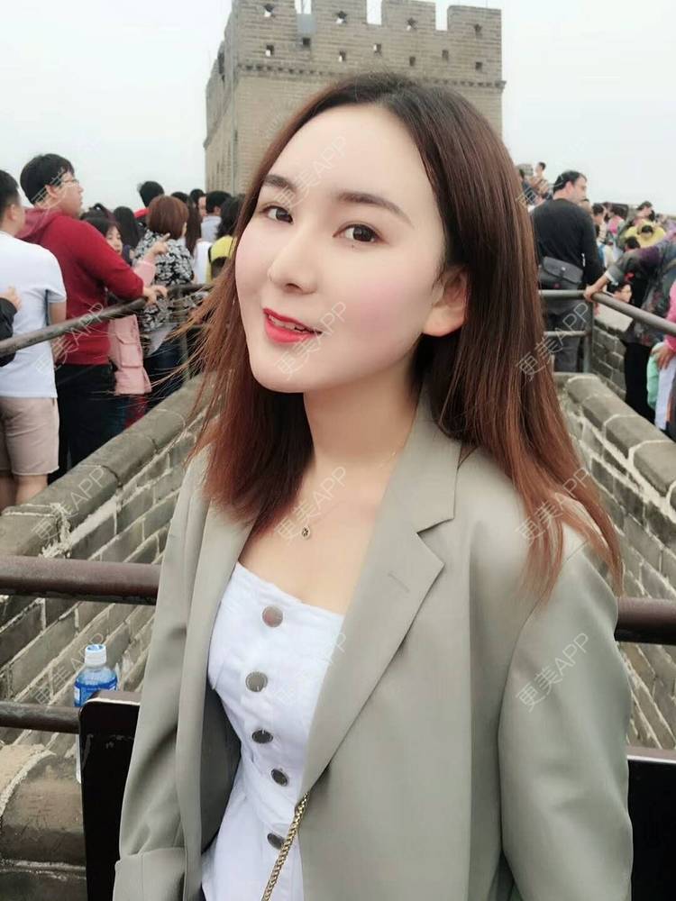 更美 - 真洋洋的背部吸脂经验 | 背部吸脂 | 吸脂瘦大腿 | 小腿吸脂 | 深圳 | 吸脂塑臀 | 吸脂