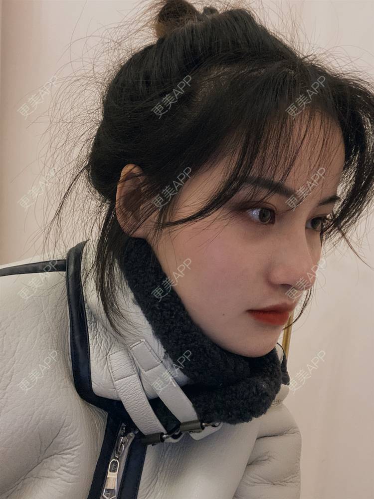 时光流逝已久的鼻综合日记