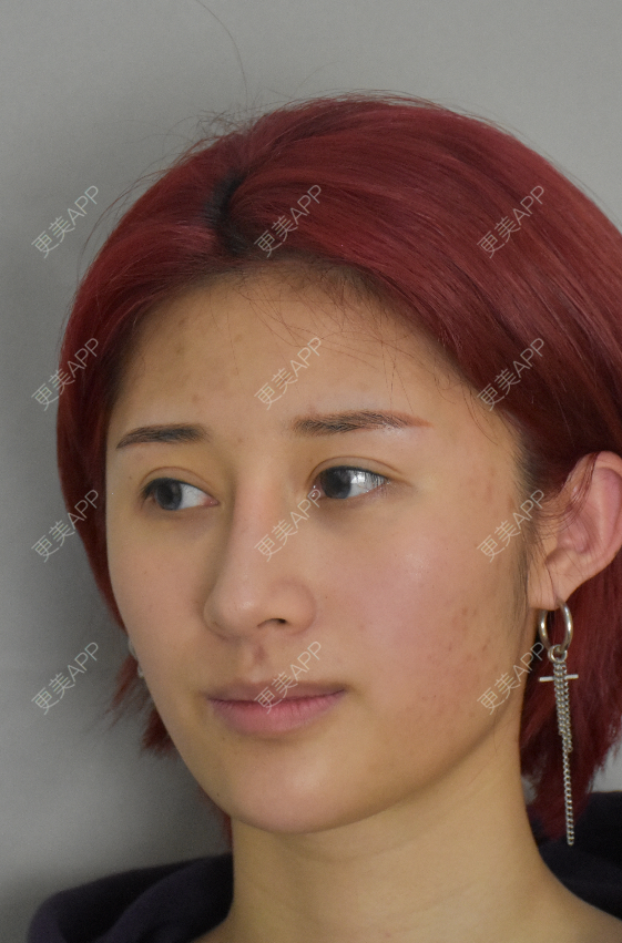 更美 - 更美用户ipvteMCgsT的清洁水光补水经验 | 清洁水光补水