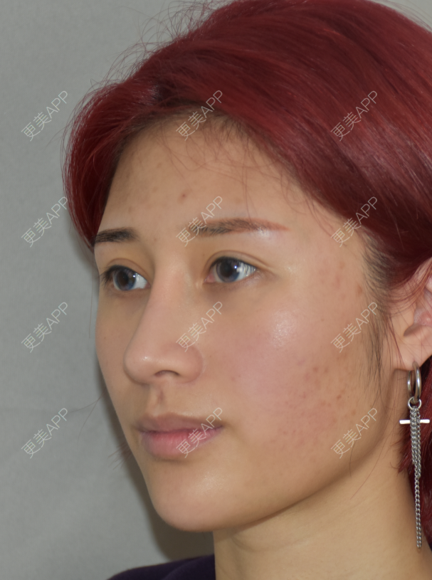 更美 - 更美用户ipvteMCgsT的清洁水光补水经验 | 清洁水光补水