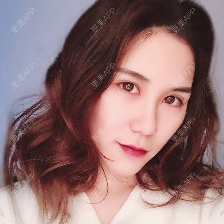 更美 - 我会有猫的i的双眼皮经验 | 视频日记 | 双眼皮 | 重庆