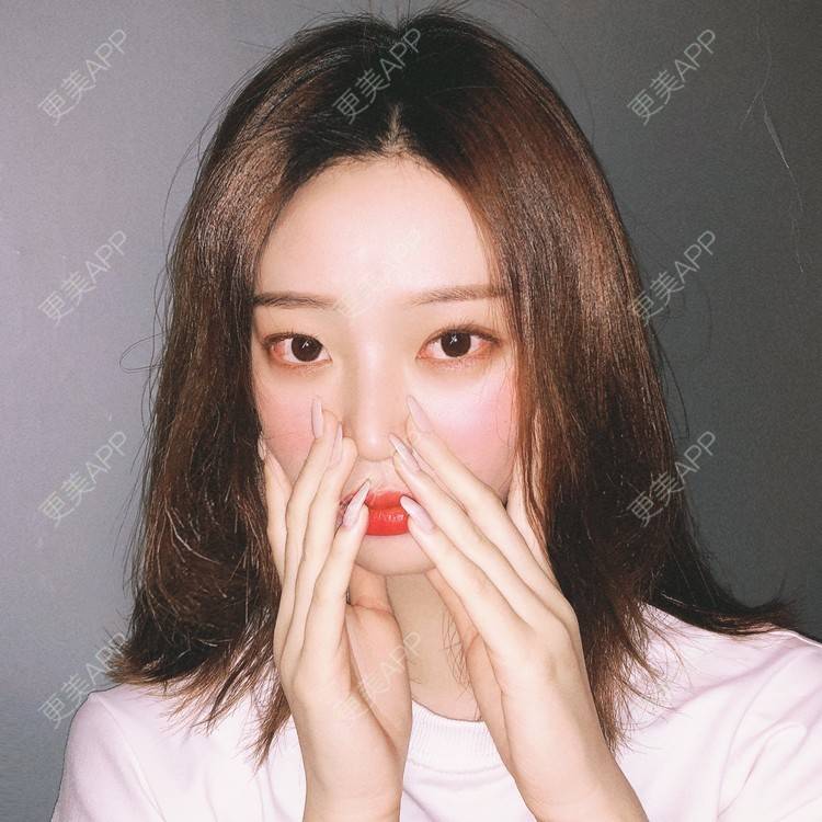更美 - 猫小姐呀的鼻部多项经验 | 广州 | 视频日记 | 鼻部多项