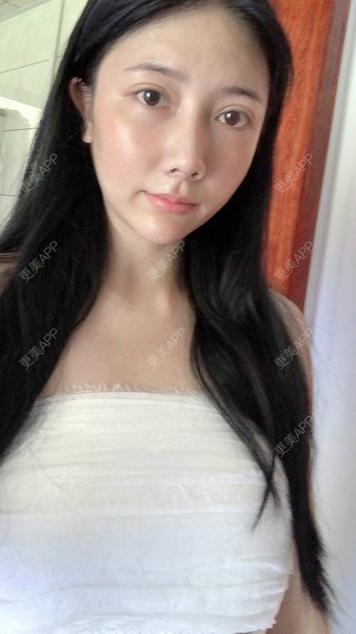 更美用户g4r11lcqv9的丰胸隆胸日记