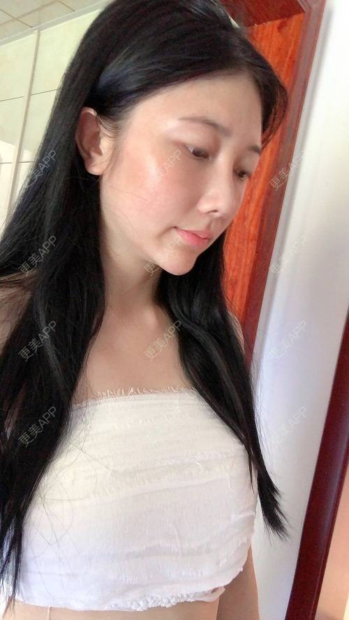 更美用户g4r11lcqv9的丰胸隆胸日记